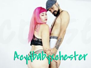 Acydbabyxchester