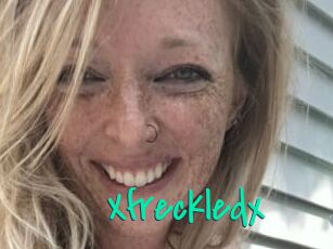 Xfreckledx